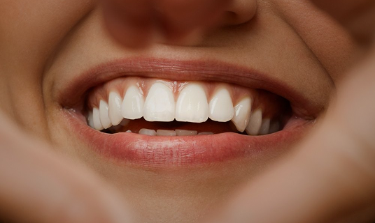 Bright white teeth