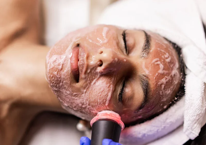 A women getting a glo2 facial close up