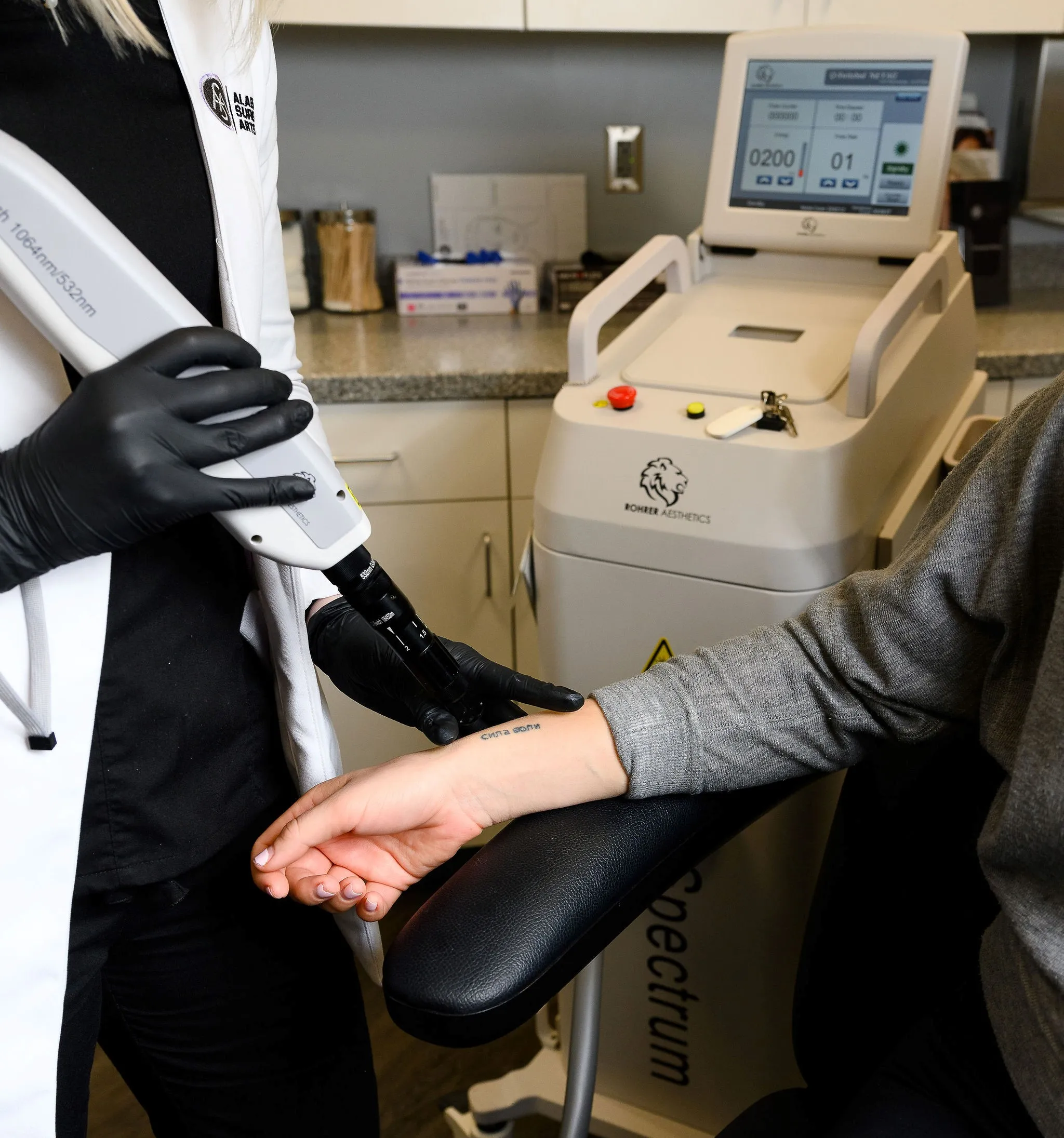 A tattoo removal being preformed on the wrist area