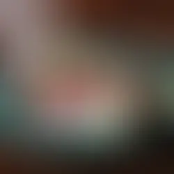 Carpaccio de melon jaune, fêta, mûres et grenade