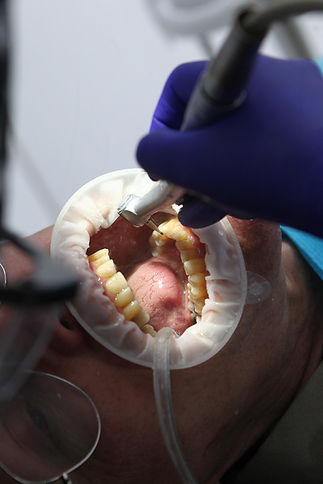 diegotoralabad-dentist-7397737_1920.jpg