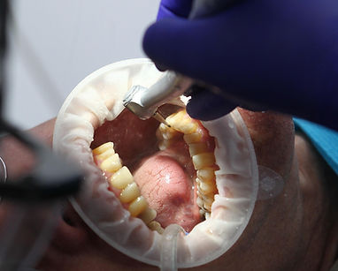 diegotoralabad-dentist-7397737_1920.jpg