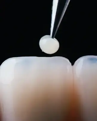 Restorative-Dentistry-1.webp