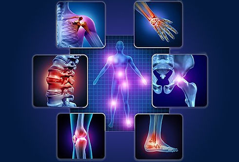 osteoarthritis-vs-ra.jpg