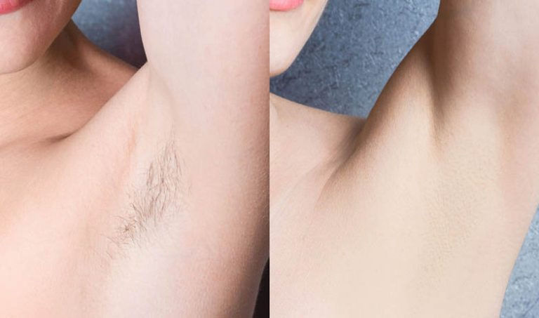 ARMPIT