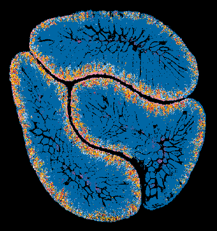 UMAPtoSpat_CellType40-ezgif.com-added-text.gif