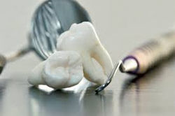 ขูดหินปูน Scaling and Polishing