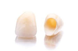 All Ceramic crown