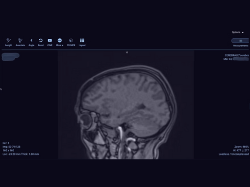 Exposed to the Bare Bone: When Private Medical Scans Surface on the Internet