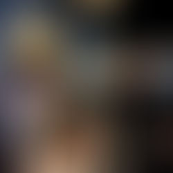 Plasma Rico en Plaquetas (PRP) para dolor en cadera