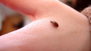 Bed Bug on a hand in Dallas, texas