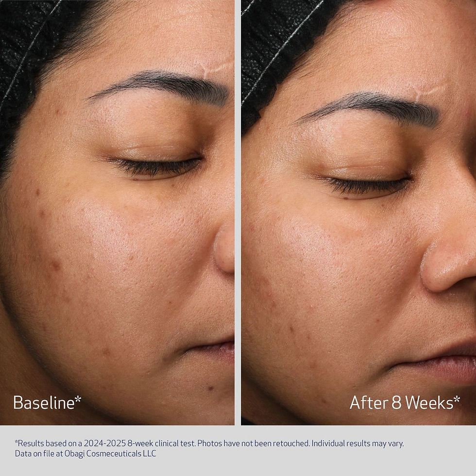 Thumbnail: Obagi Retinol+PHA Night Cream