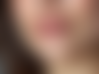 Unlocking the Secrets of Lower Face Botox: Benefits and Considerations