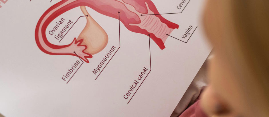 endometriose