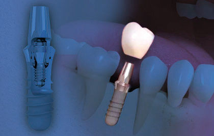 SUIVI DE MAINTENANCE