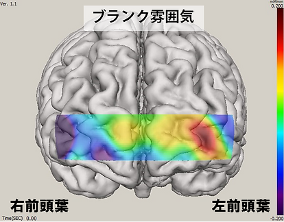 ブランク雰囲気/2-Back脳血液量画像.png
