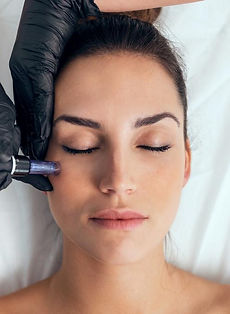 20% off Any Genius™ RF/Microneedling Treatment