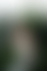 Can Hair Turn Back from Gray?Reversing Gray Hair with BBA: A Real Story & What Science Says About Pigmentation