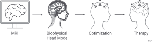 Neurotwins: Personalizing Digital Brains- Biophysical head models (tES 1.0)
