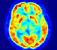 4 Awesome Brain Imaging Techniques