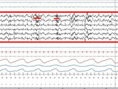 What software do I use for EEG analysis?
