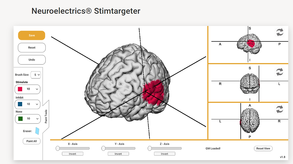 Neurotwins Personalizing Digital Brains - Optimizing a montage using a biophysical head model only: StimWeaver
