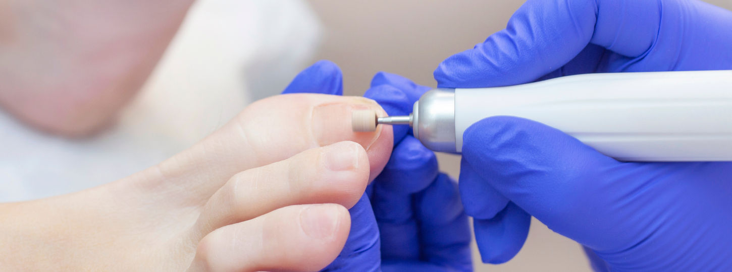 A podiatrist using a dremel tool to sand a patient's toenails