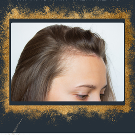 Treatments for Thinning Hair: What Are Your Options for Optimum Results