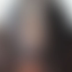 Female Pattern Hair Loss (FPHL)