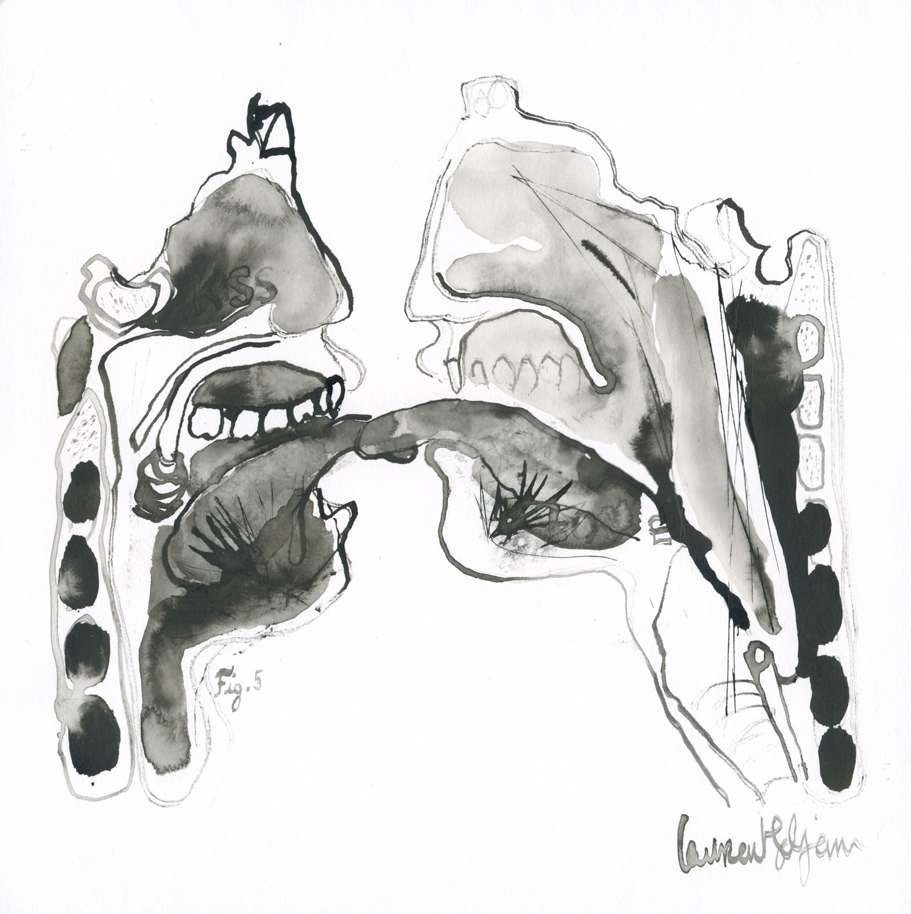 the kiss