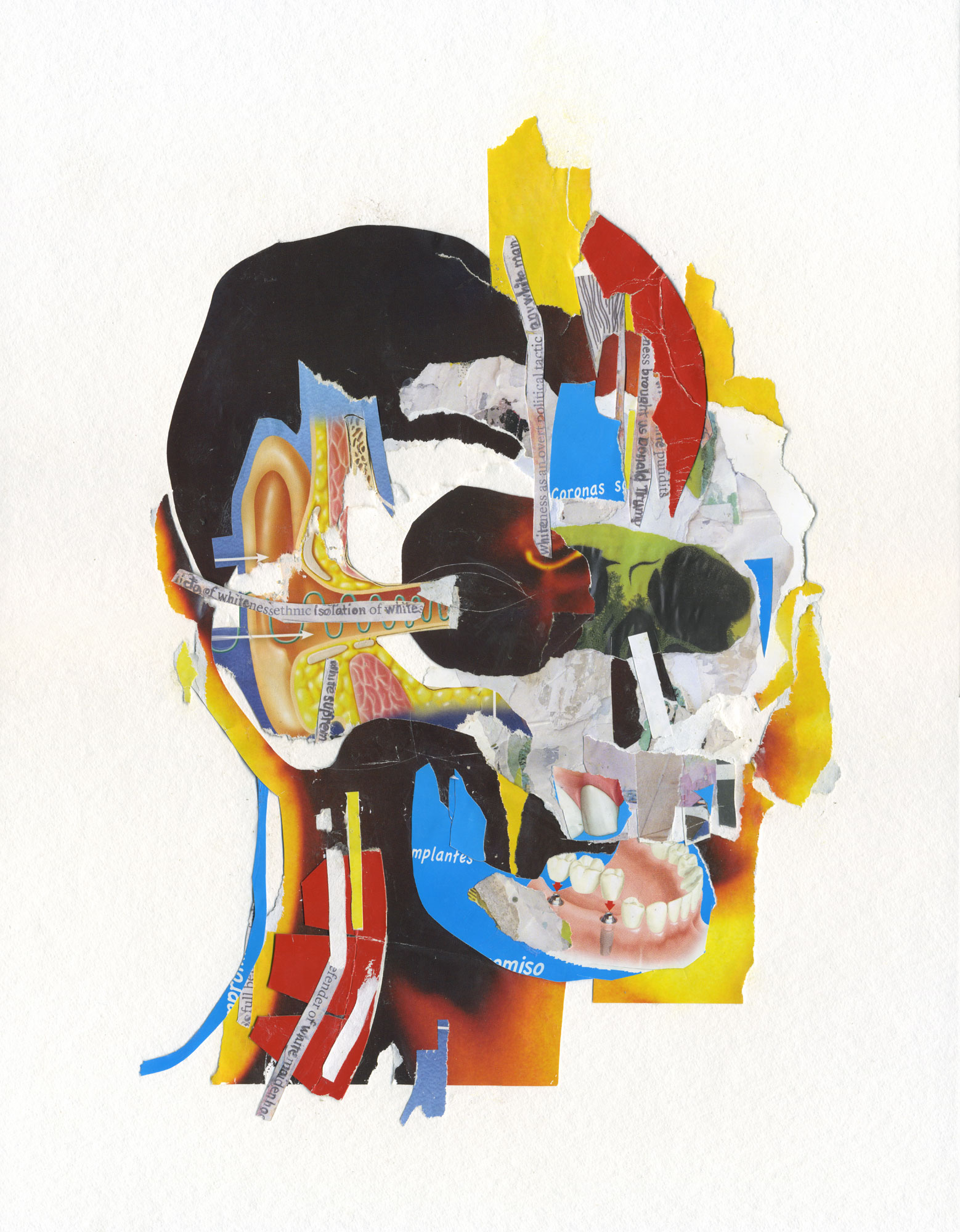 "Pain anatomy" (Basquiat tribute)