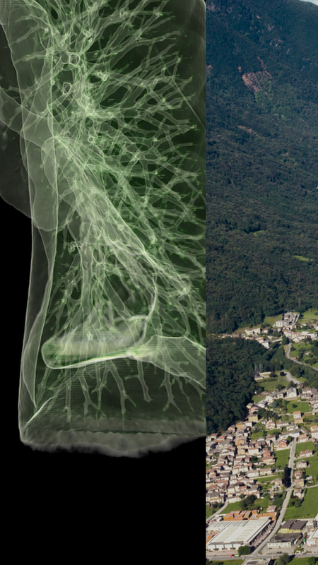 Lung Health Equity