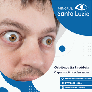 Orbitopatia Tiroideia - O que você precisa saber