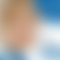 Ambliopia - Você já ouviu falar