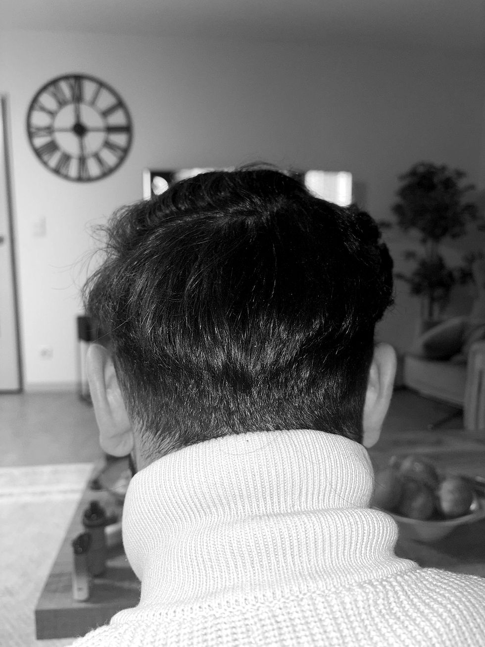 annotated donor area map showing safe extraction zones and preservation strategy.