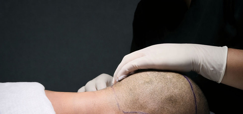 Eva Estetica Donor area