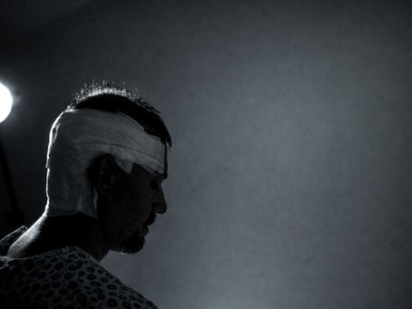 hair restoration planning based on donor preservation and long term design