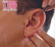 Tratamientos corporales