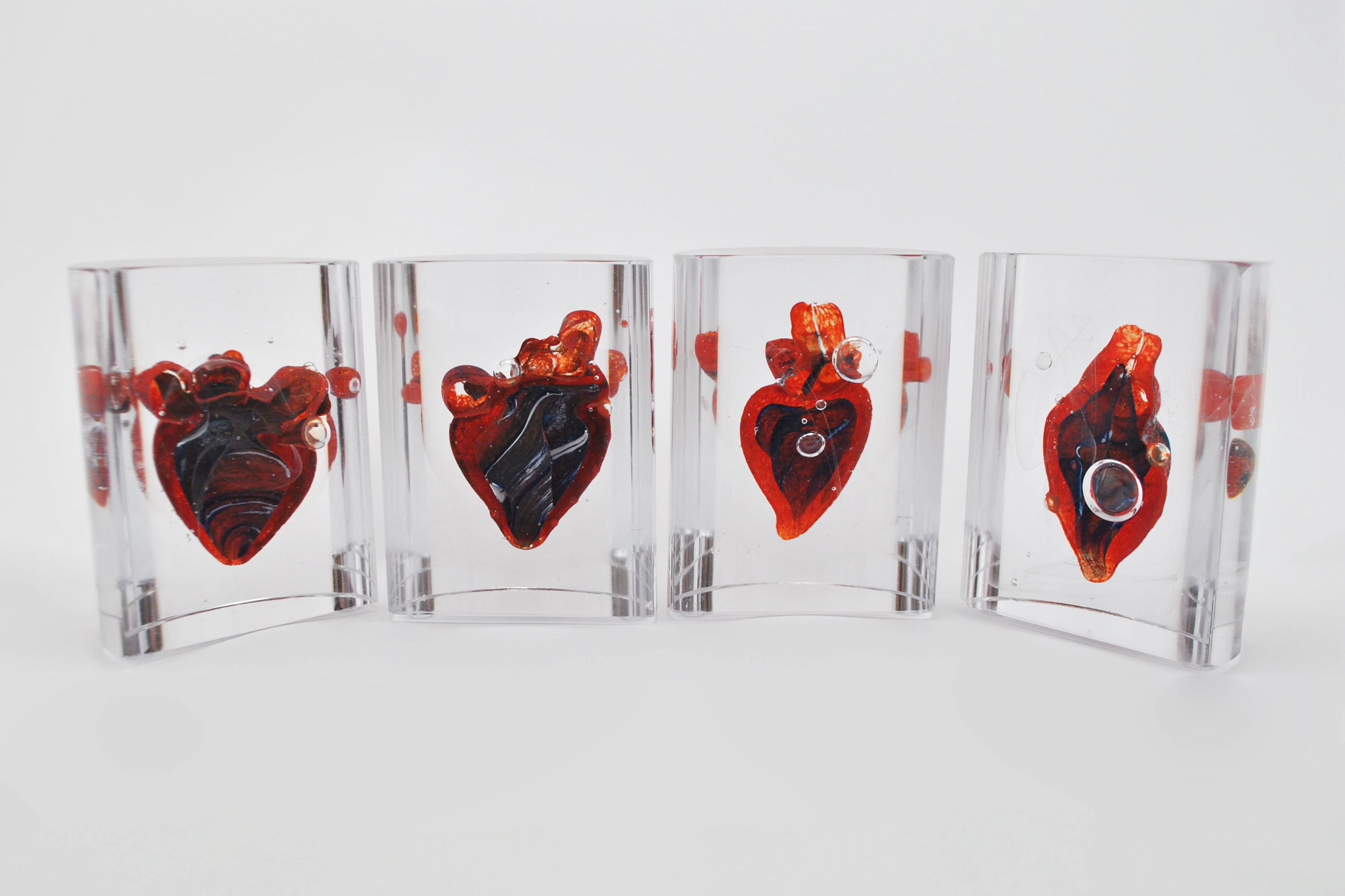 Artial Flutter & Palpitations 2015