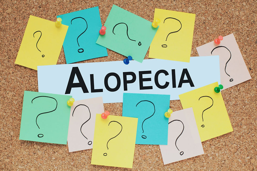 The word alopecia surrounded by question marks
