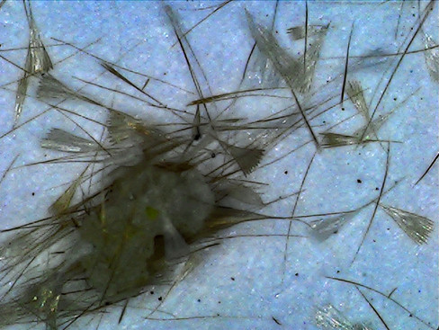 Wattle Cup Moth magnified scales