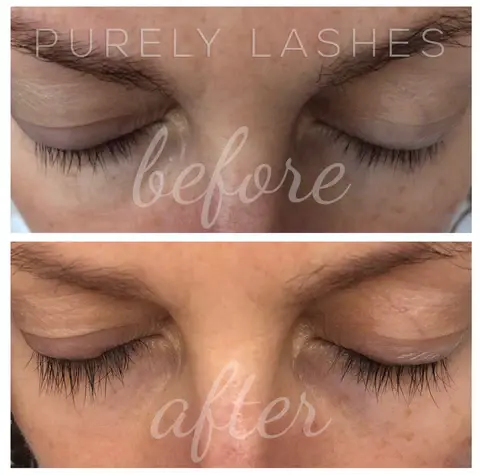 Thumbnail: Purely Lashes Lash Growth Serum