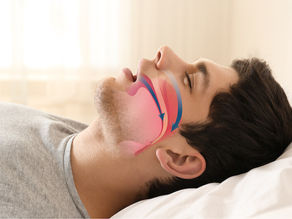 The Impact of Mouth Breathing on Facial Structure: Insights from "Jaws: A Hidden Epidemic"