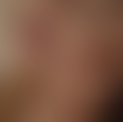 Warum deine Haut spannt – und wie du erkennst, was ihr wirklich fehlt