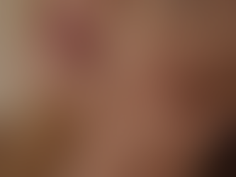 Warum deine Haut spannt – und wie du erkennst, was ihr wirklich fehlt