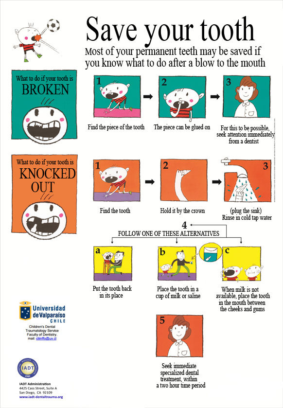Brochure IADT | Traumatisme dentaire | Sauve ta dente