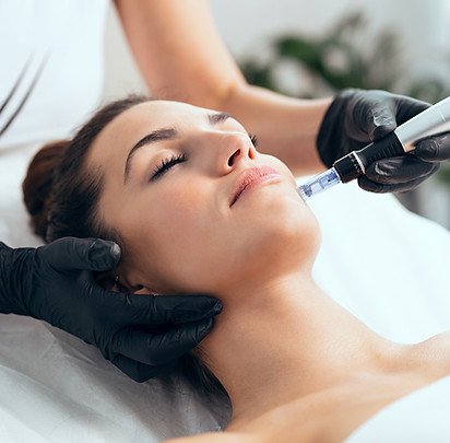 Microneedling with PRF (Platelet-Rich Fibrin) Elevated with Jaymee J. Aesthetics