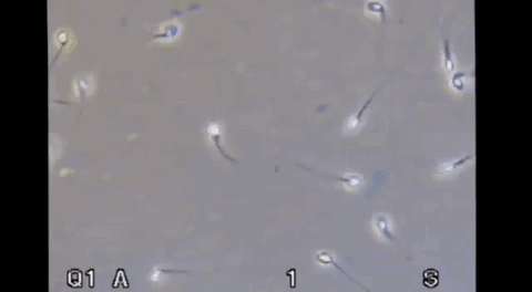Sperm.gif