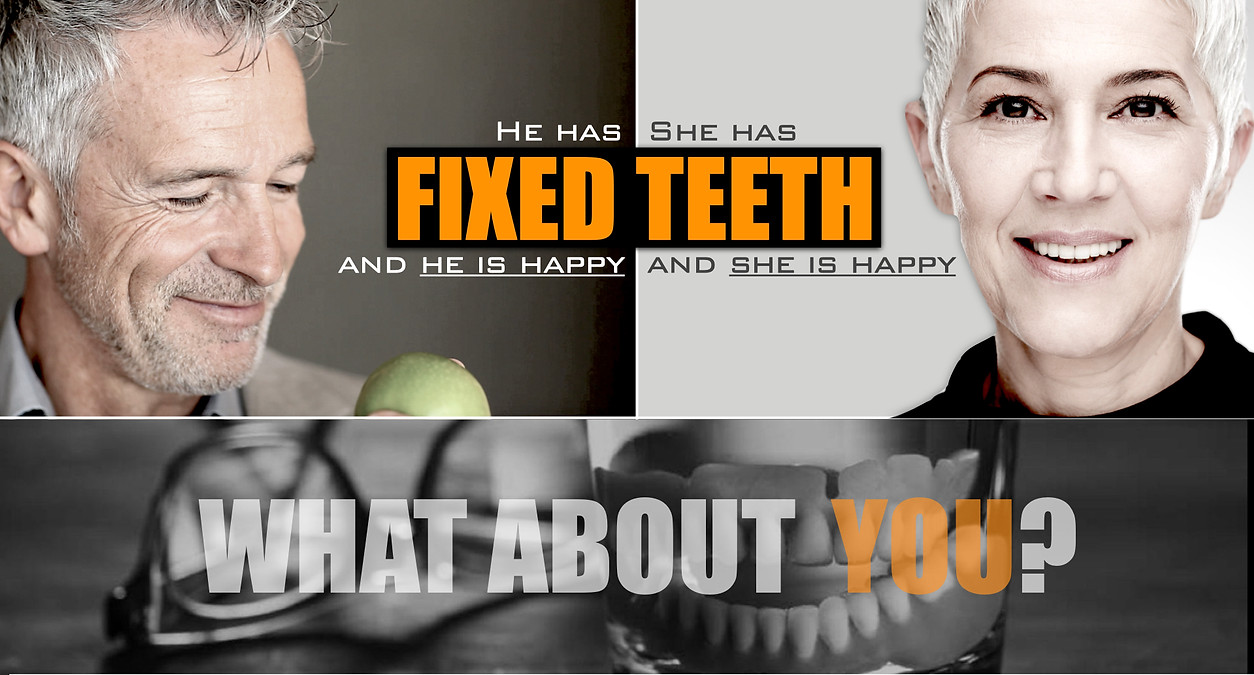 Full Mouth Implants - dental implant ful