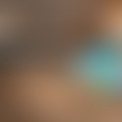 Opal Stone Benefits and Uses You Should Know